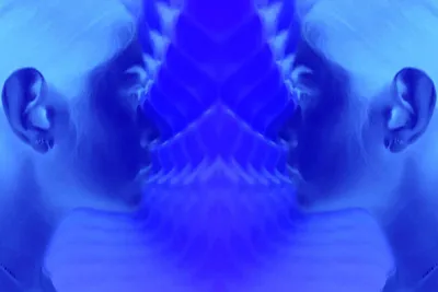 XRAY Webpost 200610 1 DN 6